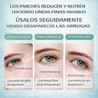 Avocado Eye Repair® + eBook Gratis -  Parches de Aguacate para una Mirada Fresca y Joven
