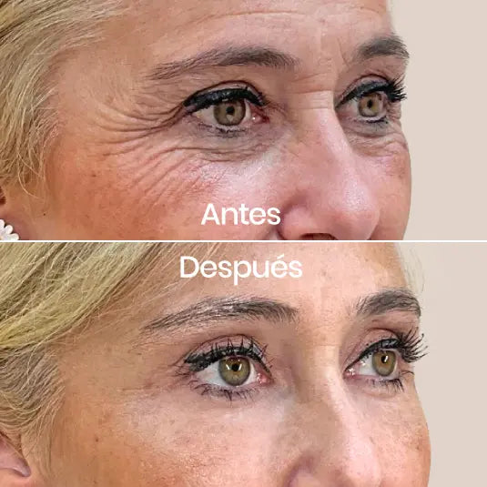 COLLAGEN PRO® - Ampolla Intensiva de Colágeno Profundo para Pieles que Necesitan Resultados Reales