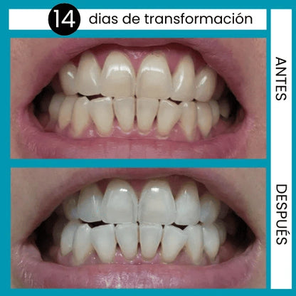 ENJUAGUE DESINTOXICACIÓN BUCAL GURUNANDA + RASPADOR DE LENGUA GRATIS