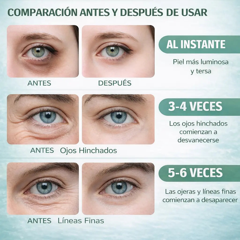 Avocado Eye Repair® + eBook Gratis -  Parches de Aguacate para una Mirada Fresca y Joven